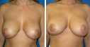 Before & After Photos